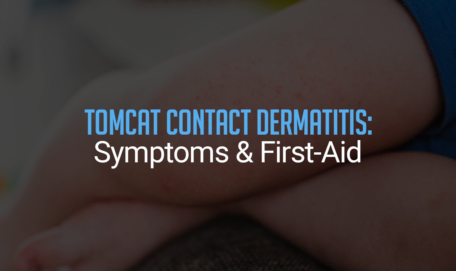 Tomcat Contact Dermatitis: Symptoms & First-Aid Essentials
